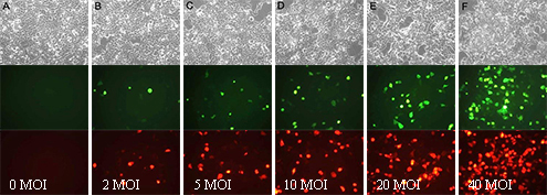 Ad-mCherry-GFP-LC3B