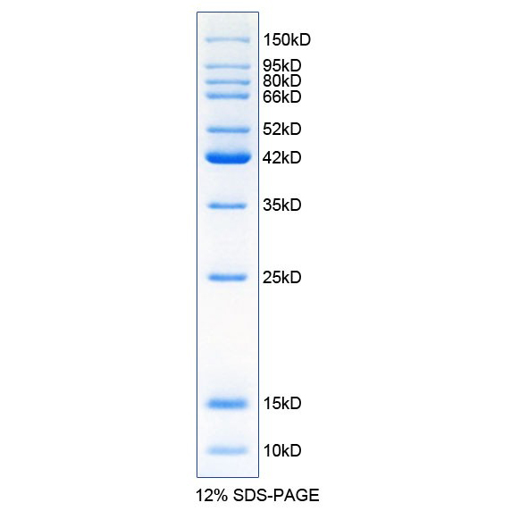蛋白Marker(10~150kD) 蛋白Marker(10~150kD)