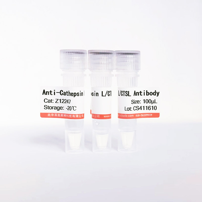 Cathepsin L/CTSL抗体图片 Cathepsin L/CTSL抗体图片
