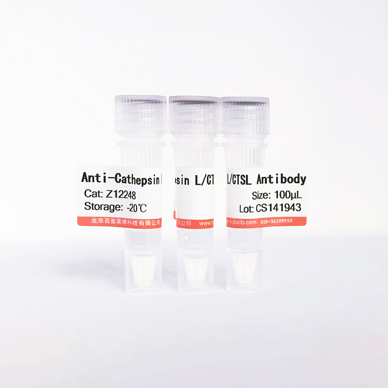 Cathepsin L/CTSL抗体图片 Cathepsin L/CTSL抗体图片