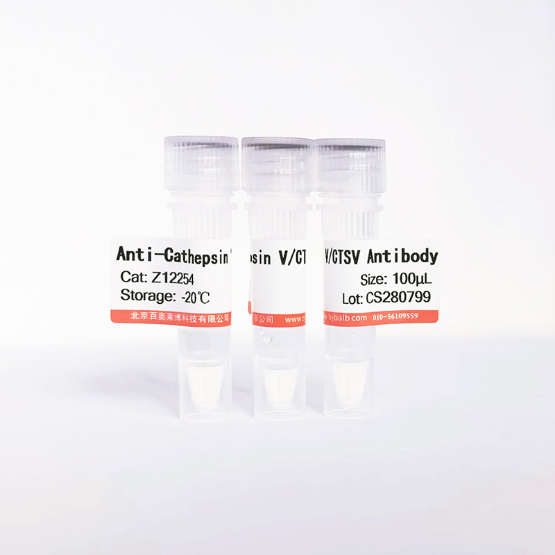 Cathepsin V/CTSV抗体图片 Cathepsin V/CTSV抗体图片