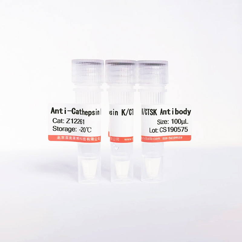 Cathepsin K/CTSK抗体图片 Cathepsin K/CTSK抗体图片