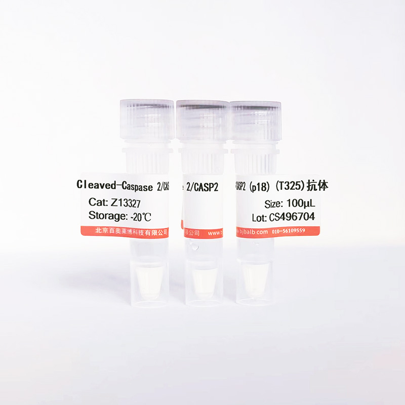 Cleaved-Caspase 2/CASP2 (p18) (T325)抗体图片 Cleaved-Caspase 2/CASP2 (p18) (T325)抗体图片