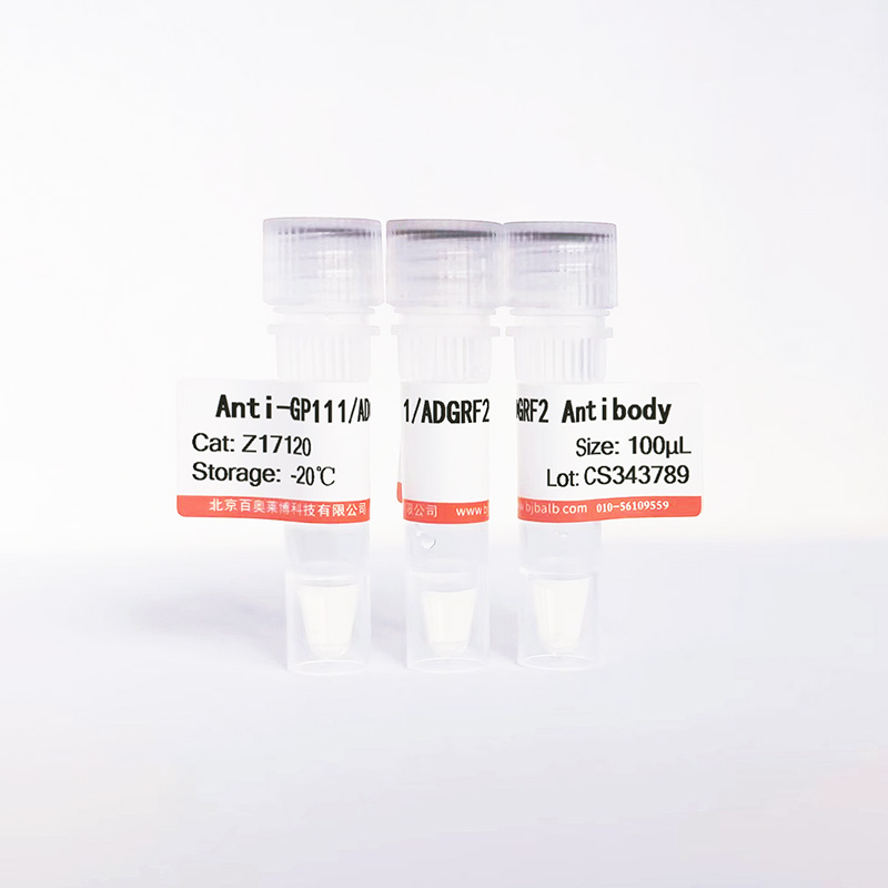 GP111/ADGRF2抗体图片 GP111/ADGRF2抗体图片