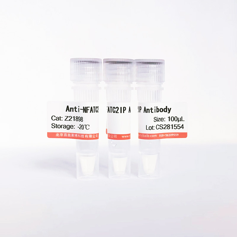 NFATC2IP抗体图片