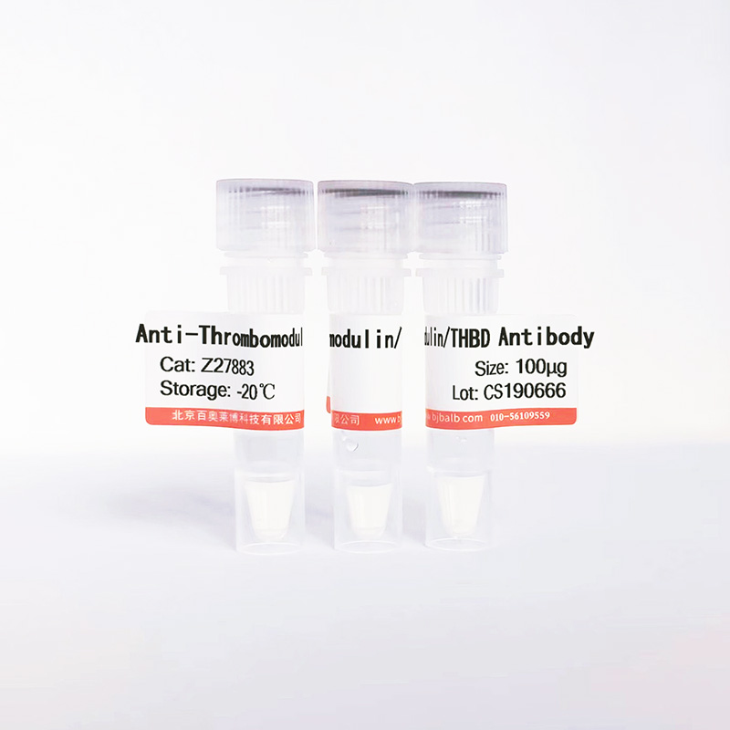 Thrombomodulin/THBD抗体图片 Thrombomodulin/THBD抗体图片