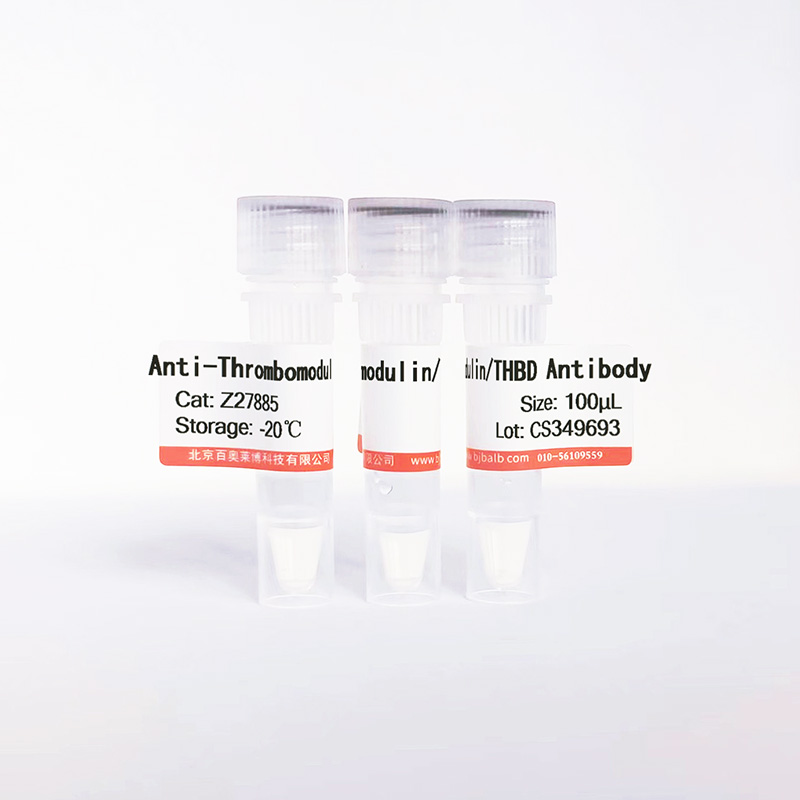 Thrombomodulin/THBD抗体图片 Thrombomodulin/THBD抗体图片