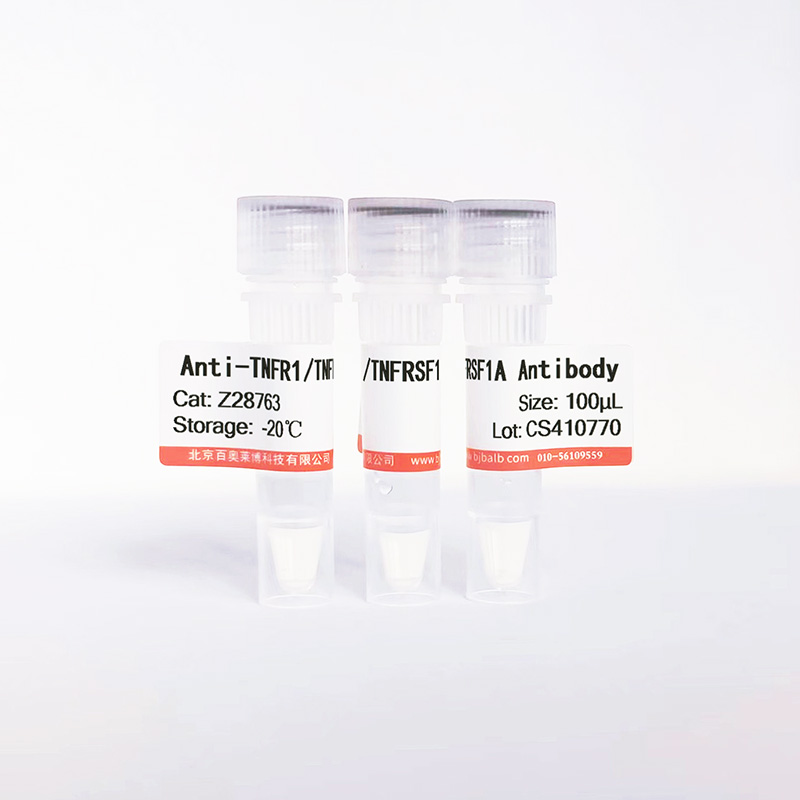 TNFR1/TNFRSF1A抗体图片 TNFR1/TNFRSF1A抗体图片