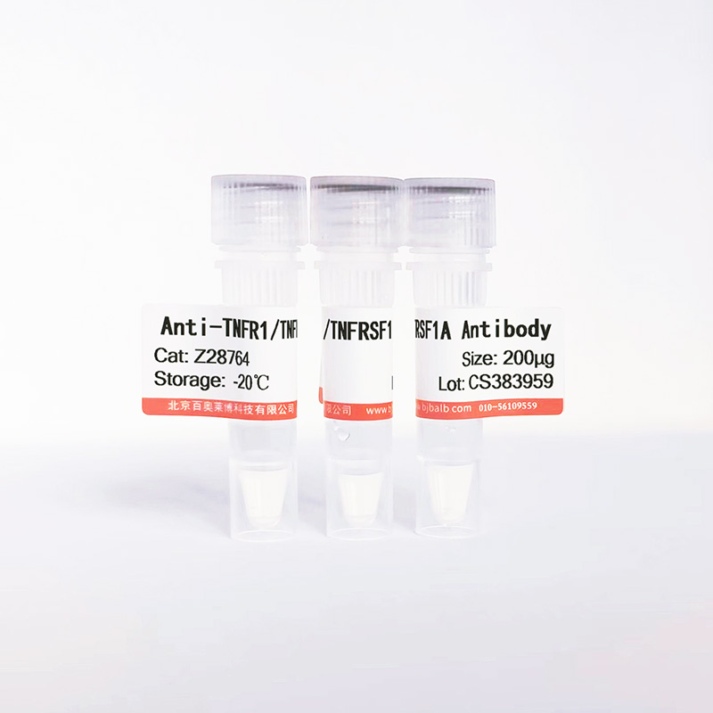 TNFR1/TNFRSF1A抗体图片 TNFR1/TNFRSF1A抗体图片