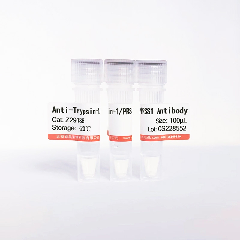 Trypsin-1/PRSS1抗体图片 Trypsin-1/PRSS1抗体图片