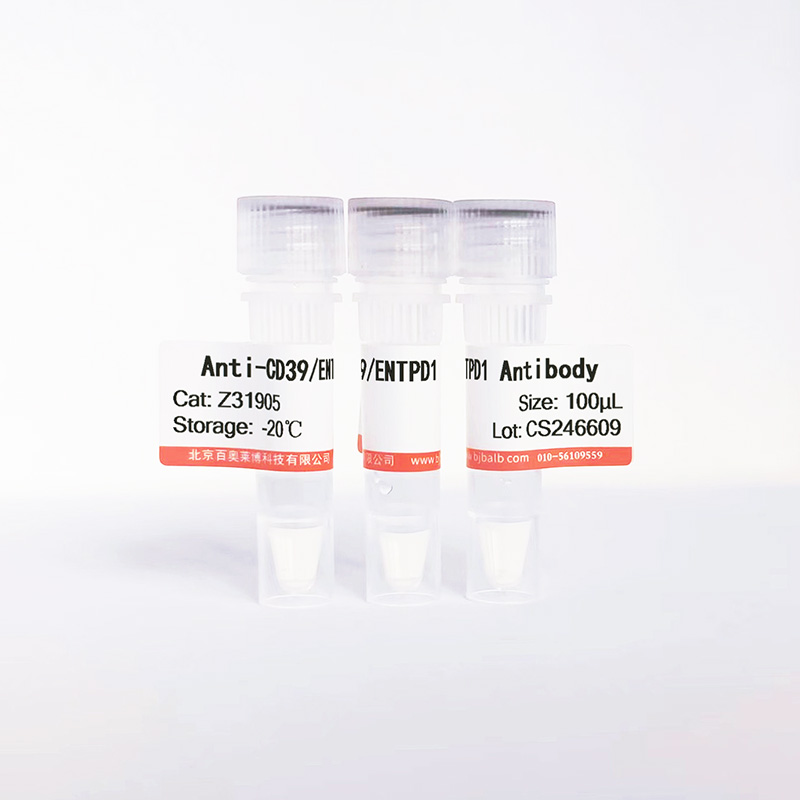 CD39/ENTPD1抗体图片 CD39/ENTPD1抗体图片