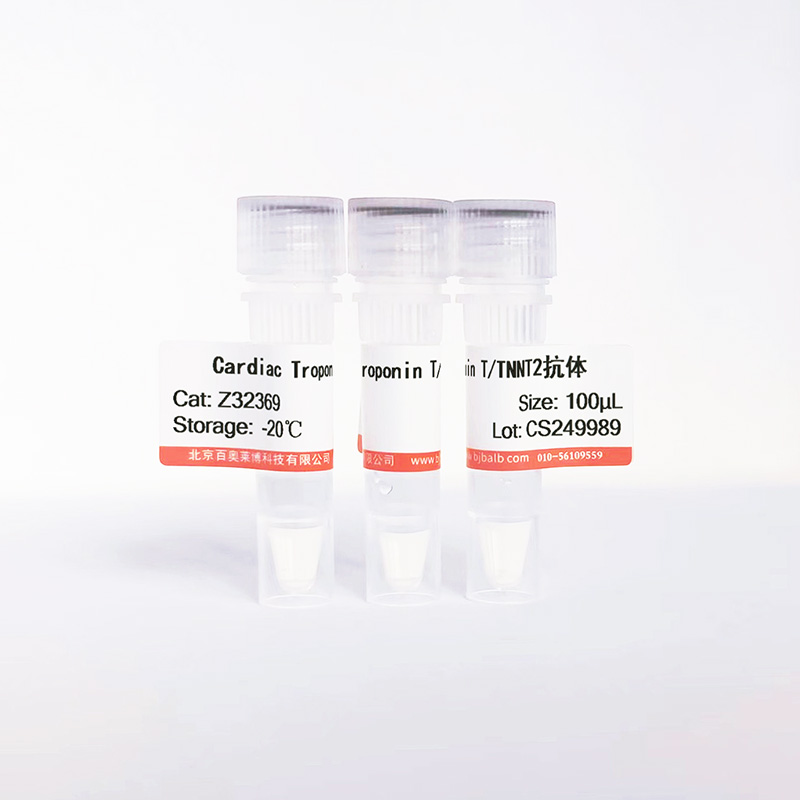 Cardiac Troponin T/TNNT2抗体图片 Cardiac Troponin T/TNNT2抗体图片