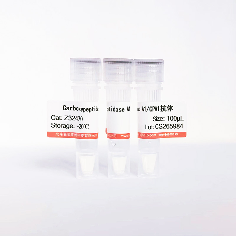 Carboxypeptidase A1/CPA1抗体图片 Carboxypeptidase A1/CPA1抗体图片
