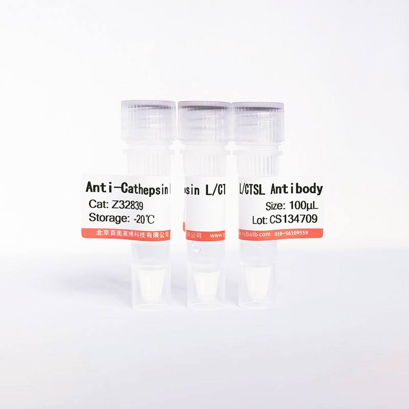 Cathepsin L/CTSL抗体图片 Cathepsin L/CTSL抗体图片