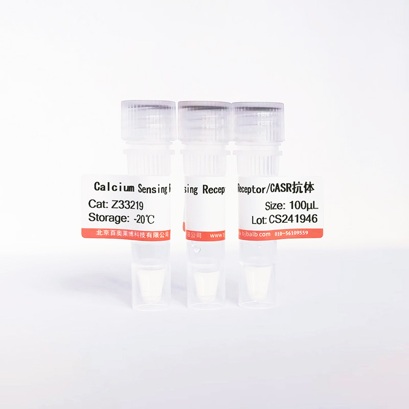 Calcium Sensing Receptor/CASR抗体图片 Calcium Sensing Receptor/CASR抗体图片