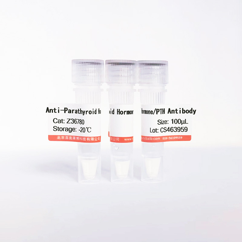 Parathyroid Hormone/PTH抗体图片 Parathyroid Hormone/PTH抗体图片