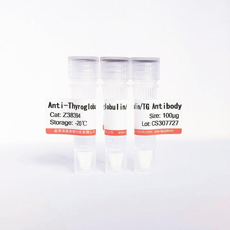Thyroglobulin/TG抗体图片 Thyroglobulin/TG抗体图片
