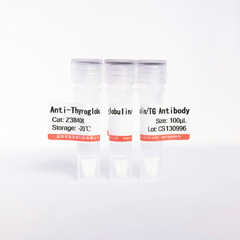 Thyroglobulin/TG抗体图片 Thyroglobulin/TG抗体图片