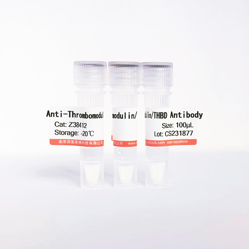 Thrombomodulin/THBD抗体图片 Thrombomodulin/THBD抗体图片