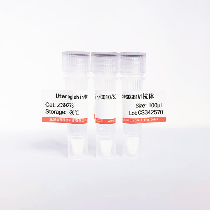 Uteroglobin/CC10/SCGB1A1抗体图片