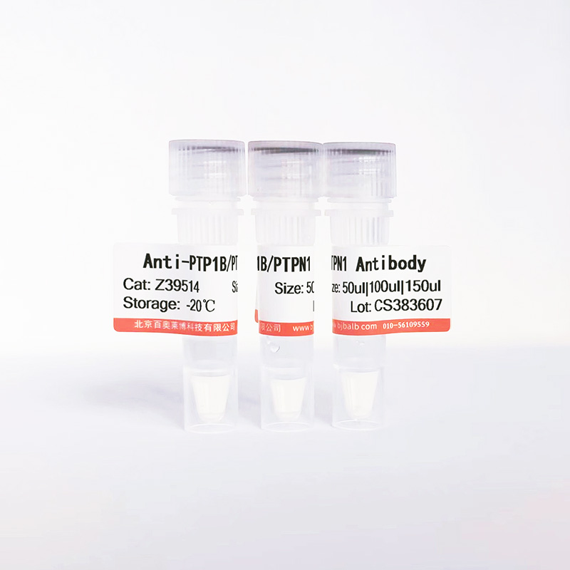 PTP1B/PTPN1抗体图片 PTP1B/PTPN1抗体图片